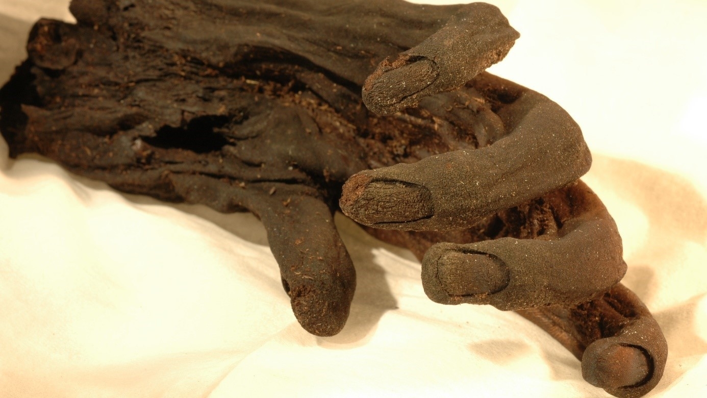 <i>An der Hand der im Jahre 2000 entdecken, ca. 2650 Jahre alten Moorleiche ‚Moora‘ sind Haut und Fingernägel erkennbar.</i>